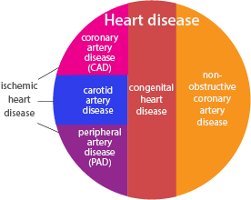 heart disease